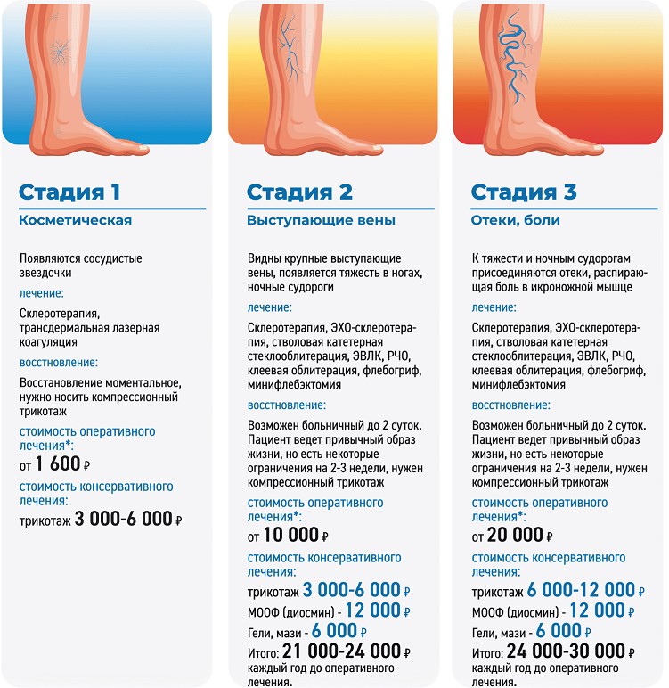 Причины варикозного расширения вен нижних. Ранняя стадия варикоза.